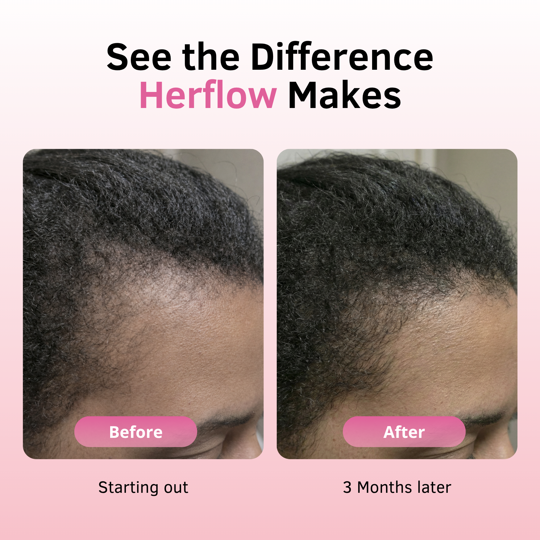 Herflow Hair Strength-3