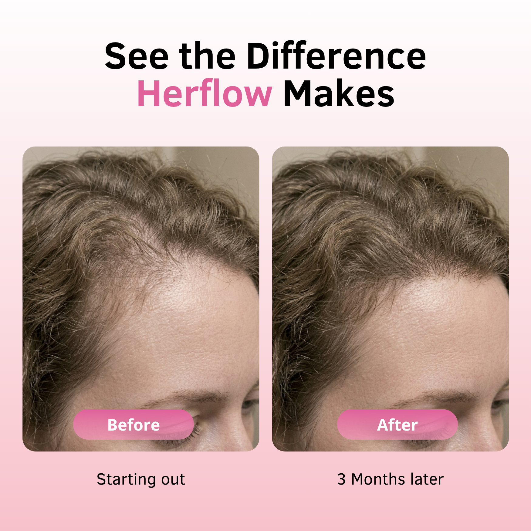 Herflow Hair Recovery